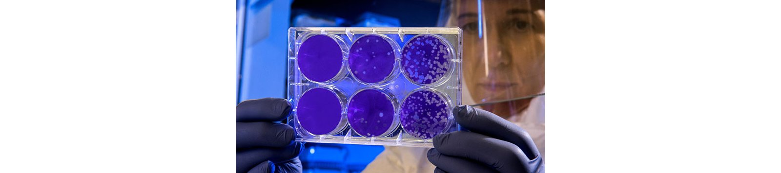 Virus detection with electrochemistry