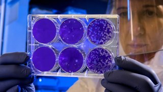 Virus detection with electrochemistry
